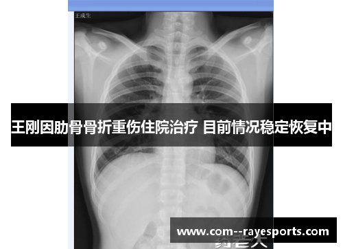 王刚因肋骨骨折重伤住院治疗 目前情况稳定恢复中 王刚因肋骨骨折重伤住院治疗 目前情况稳定恢复中